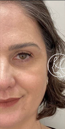 Antes da harmonização