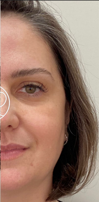 Depois da harmonização