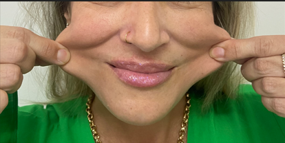 Antes da harmonização