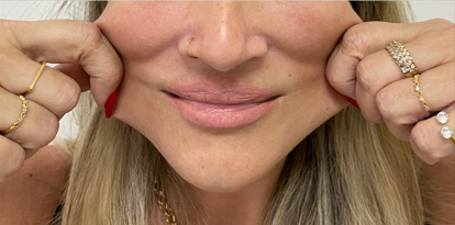 Depois da harmonização