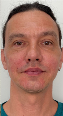 Depois da harmonização